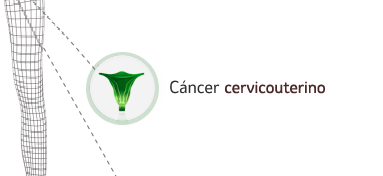 Imagen indicación cáncer cervicouterino